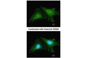 ICC/IF Image Immunofluorescence analysis of methanol-fixed HeLa, using RNF25, antibody at 1:200 dilution. (RNF25 antibody  (C-Term))