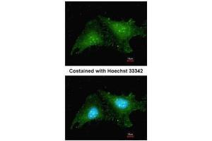 ICC/IF Image Immunofluorescence analysis of methanol-fixed HeLa, using RNF25, antibody at 1:200 dilution. (RNF25 antibody  (C-Term))