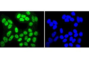 HeLa cells were stained with SIRT1(T530) (6H5) Monoclonal Antibody  at [1:200] incubated overnight at 4C, followed by secondary antibody incubation, DAPI staining of the nuclei and detection. (SIRT1 antibody  (pThr530))