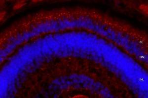 IF analysis of Ush2a using anti-Ush2a antibody (ABIN7603826).