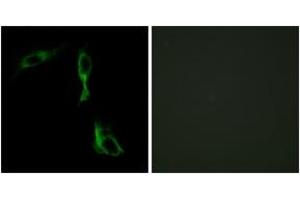 Immunofluorescence analysis of HeLa cells, using ADRA1D Antibody. (ADRA1D antibody  (AA 451-500))