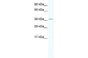 WB Suggested Anti-TOB1 Antibody Titration:  1. (Protein Tob1 (TOB1) (Middle Region) antibody)