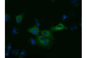 Anti-KLHL2 mouse monoclonal antibody (ABIN2453211) immunofluorescent staining of COS7 cells transiently transfected by pCMV6-ENTRY KLHL2 (RC205347). (KLHL2 antibody  (AA 1-100, AA 494-593))