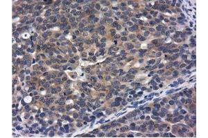 Immunohistochemistry (IHC) image for anti-COBW Domain Containing 1 (CBWD1) antibody (ABIN1497117) (CBWD1 antibody)