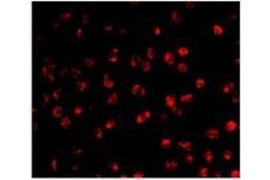 Immunofluorescence of AID in Ramos cells with AP30028PU-N Ramos antibody at 20 μg/ml. (AICDA antibody  (C-Term))