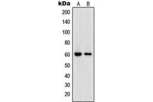 Western blot analysis of DNA Polymerase epsilon 2 expression in HL60 (A), HeLa (B) whole cell lysates. (POLE2 antibody  (Center))
