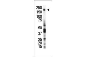 Western blot analysis of anti-RON Pab (ABIN392048 and ABIN2841815) in THP1 cell lysate. (MST1R antibody  (AA 22-51, AA 1370-1400))