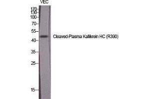 Western Blot (WB) analysis of specific cells using Cleaved-Plasma Kallikrein HC (R390) Polyclonal Antibody. (Plasma Kallikrein HC (Arg390), (cleaved) antibody)