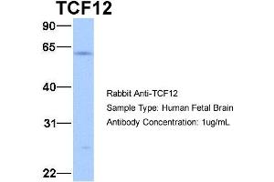 Host:  Rabbit  Target Name:  TCF12  Sample Type:  Human Fetal Brain  Antibody Dilution:  1. (TCF12 antibody  (N-Term))
