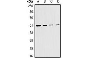 Western blot analysis of Citrate Synthase expression in HepG2 (A), MCF7 (B), mouse liver (C), rat testis (D) whole cell lysates. (CS antibody)