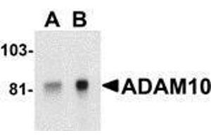 Western Blotting (WB) image for anti-ADAM Metallopeptidase Domain 10 (ADAM10) antibody (ABIN2478644) (ADAM10 antibody)