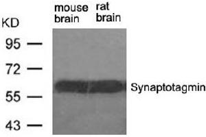 Image no. 2 for anti-Synaptotagmin I (SYT1) (Ser309) antibody (ABIN401634)