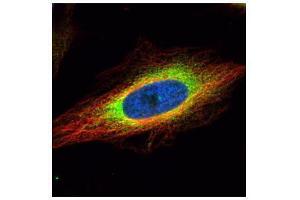 Immunofluorescence (IF) image for anti-Heat Shock Protein 90kDa beta (Grp94), Member 1 (HSP90B1) (C-Term) antibody (ABIN2855586)