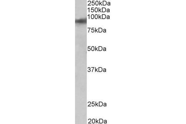 ZNF652 抗体  (AA 594-606)