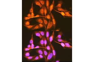 Immunofluorescence analysis of U-2 OS cells using hnRNP E1/hnRNP E1/PCBP1 Rabbit pAb (ABIN6134408, ABIN6145277, ABIN6145278 and ABIN6214692) at dilution of 1:100 (40x lens). (PCBP1 antibody  (AA 100-200))