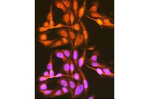 Immunofluorescence analysis of U-2 OS cells using hnRNP E1/hnRNP E1/PCBP1 Rabbit pAb (ABIN6134408, ABIN6145277, ABIN6145278 and ABIN6214692) at dilution of 1:100 (40x lens). (PCBP1 antibody  (AA 100-200))