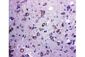 IHC-P: TRPC6 antibody testing of rat brain tissue (TRPC6 antibody  (Middle Region))