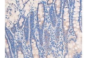 Immunohistochemistry (IHC) image for anti-Checkpoint Kinase 2 (CHEK2) (pThr68) antibody (ABIN6256592)