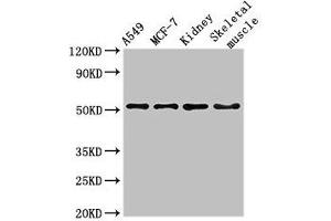 Western Blot Positive WB detected in: A549 whole cell lysate, MCF-7 whole cell lysate, Mouse kidney tissue, Mouse skeletal muscle tissue All lanes: NARF antibody at 3 μg/mL Secondary Goat polyclonal to rabbit IgG at 1/50000 dilution Predicted band size: 52, 57, 46, 45 kDa Observed band size: 52 kDa