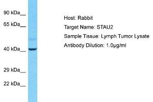 Host: Rabbit Target Name: STAU2 Sample Tissue: Human Lymph Tumor Antibody Dilution: 1ug/ml (Double-stranded RNA-binding protein Staufen homolog 2 (STAU2) (C-Term) antibody)