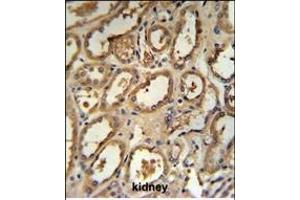 DCP2 Antibody (Center) (ABIN653129 and ABIN2842708) IHC analysis in formalin fixed and paraffin embedded human kidney tissue followed by peroxidase conjugation of the secondary antibody and DAB staining.