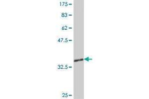 Western Blot detection against Immunogen (37 KDa) . (ZHX1 antibody  (AA 731-829))