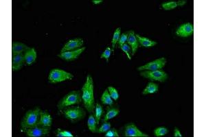 Immunofluorescent analysis of HepG2 cells using ABIN7172875 at dilution of 1:100 and Alexa Fluor 488-congugated AffiniPure Goat Anti-Rabbit IgG(H+L) (TRPV1 antibody  (AA 1-155))