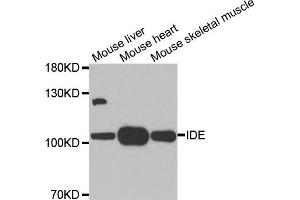 Western blot analysis of extracts of various tissues, using IDE antibody. (IDE antibody)