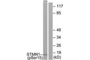 Western blot analysis of extracts from 293 cells, using Stathmin 1 (Phospho-Ser15) Antibody.