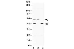Western blot testing of human 1) HeLa, 2) U-2 OS and 3) MCF7 lysate with E2F4 antibody at 0. (E2F4 antibody  (AA 106-144))