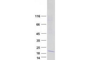 Western Blotting (WB) image for Interferon Induced Transmembrane Protein 5 (IFITM5) protein (Myc-DYKDDDDK Tag) (ABIN2723538)
