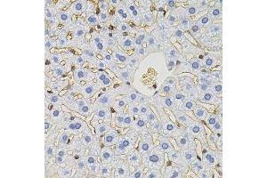 Immunohistochemistry of paraffin-embedded mouse liver using SLC6A1 antibody.