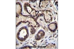 Immunohistochemistry (Paraffin-embedded Sections) (IHC (p)) image for anti-Eukaryotic Translation Initiation Factor 2B, Subunit 5 Epsilon, 82kDa (EIF2B5) (AA 36-65), (N-Term) antibody (ABIN657014)