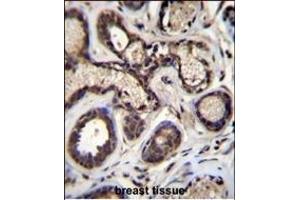 EIF2B5 Antibody (N-term) (ABIN657014 and ABIN2846194) immunohistochemistry analysis in formalin fixed and paraffin embedded human breast tissue followed by peroxidase conjugation of the secondary antibody and DAB staining. (EIF2B5 antibody  (N-Term))