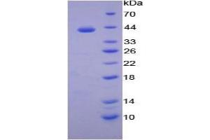 SDS-PAGE of Protein Standard from the Kit  (Highly purified E. (Transferrin Receptor 2 ELISA Kit)