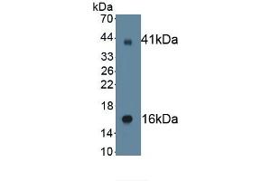 SCNN1G antibody  (AA 80-401)