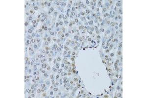 Immunohistochemistry of paraffin-embedded rat liver using HNF4A Antibody (ABIN5971111) at dilution of 1/100 (40x lens). (HNF4A antibody)
