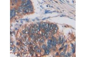 Figure. (TWEAK antibody  (AA 65-247))