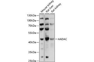 Western blot analysis of extracts of various cell lines, using AADAC antibody (ABIN6129182, ABIN6136311, ABIN6136313 and ABIN6218113) at 1:1000 dilution. (AADAC antibody  (AA 170-399))