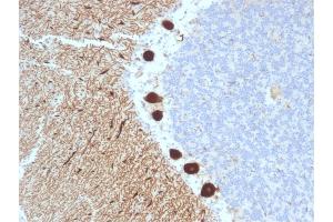 Immunohistochemistry (IHC) image for anti-Carbonic Anhydrase VIII (CA8) antibody (ABIN6940916)