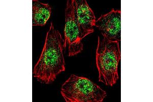Immunofluorescence (IF) image for anti-Rhox Homeobox Family, Member 2B (RHOXF2B) antibody (ABIN3000753) (RHOXF2B antibody)