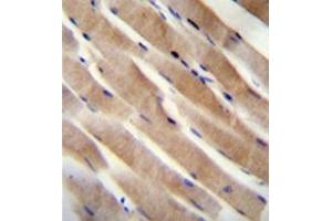 Formalin fixed, paraffin embedded human skeletal muscle stained with RHEB Antibody (C-term) followed by peroxidase conjugation of the secondary antibody and DAB staining. (RHEB antibody  (C-Term))