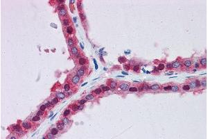 Immunohistochemistry (IHC) image for anti-Glucose-6-Phosphate Isomerase (GPI) (AA 81-93) antibody (ABIN571080)