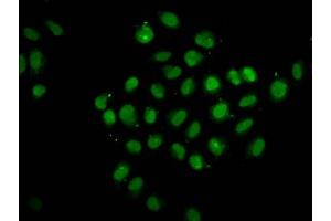 Immunofluorescence staining of Hela cells with ABIN7174097 at 1:133, counter-stained with DAPI. (PTPN14 antibody  (AA 220-351))