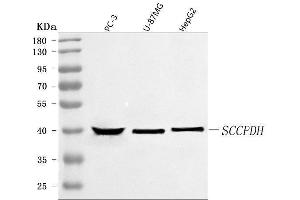 Western blot analysis of SCCPDH using anti-SCCPDH antibody (ABIN7600478).