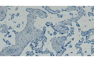 ABIN334408 Negative Control showing staining of paraffin embedded Human Placenta, with no primary antibody.