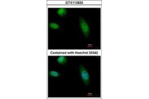Image no. 3 for anti-RAD23 Homolog B (RAD23B) (AA 164-409) antibody (ABIN1500578) (RAD23B antibody  (AA 164-409))