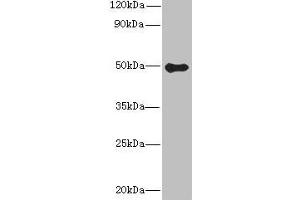 Western blot All lanes: GSDMB antibody at 8 μg/mL + Colo320 whole cell lysate Secondary Goat polyclonal to rabbit IgG at 1/10000 dilution Predicted band size: 47, 46, 48, 19 kDa Observed band size: 47 kDa (Gasdermin B antibody  (AA 63-310))
