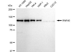 Western blotting analysis using RNF40 antibody (ABIN7800634). (Recombinant TRIM40 antibody)