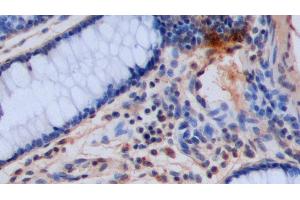Detection of 5-HT in Porcine Colon Tissue using Polyclonal Antibody to 5-Hydroxytryptamine (5-HT)